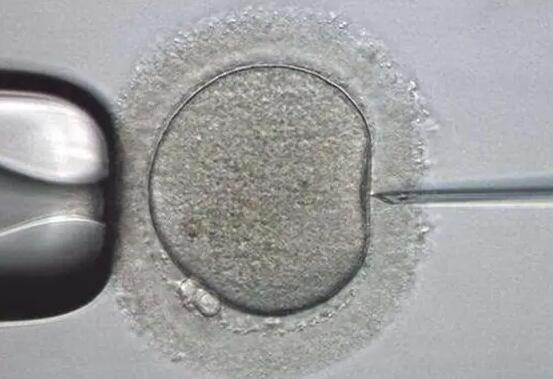 自然周期试管婴儿：激素水平变化与胚胎移植时机