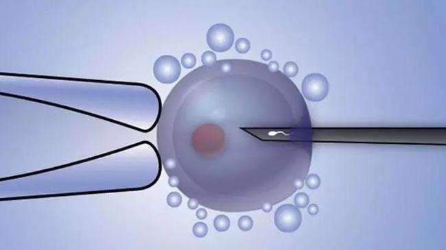 胚胎着床胚胎着床症状北京三代试管检测胚胎多少钱