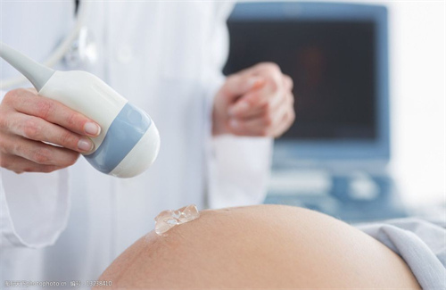 新生儿溢奶的预防与应对