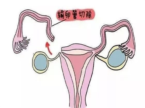 青春期多囊卵巢综合征的调理方法
