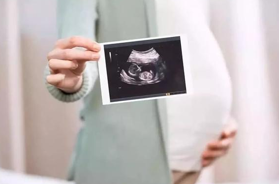 试管孕育特纳氏综合征东北试管婴儿助孕要多少钱