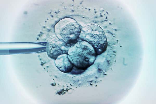 胚胎着床冻存胚胎费用北京做试管三代大概多少钱