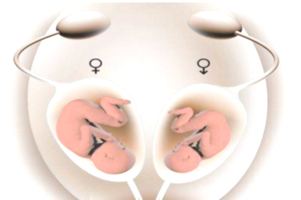试管婴儿长方案与胚胎质量：如何确保优质胚胎移植