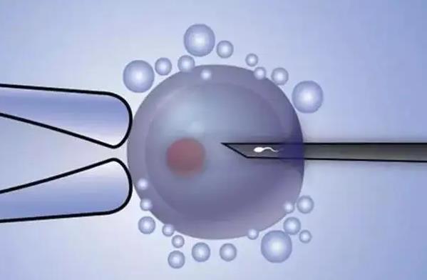 孕期胎动变化及应对方法